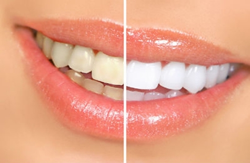 baking-soda-la-gi-baking-soda-mua-o-dau-5