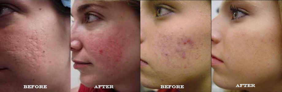 baking-soda-la-gi-baking-soda-mua-o-dau-9