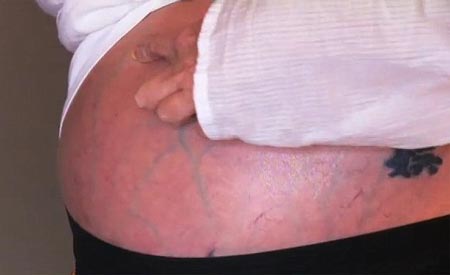 tac-dung-cua-cay-cho-de-10