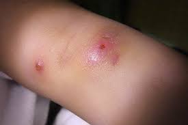 tac-dung-cua-cay-cho-de-2