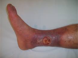 tac-dung-cua-cay-cho-de-4