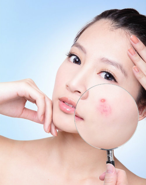 bi-quyet-tri-mun-duoi-da-hieu-qua-2