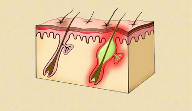 tri-viem-lo-chan-long
